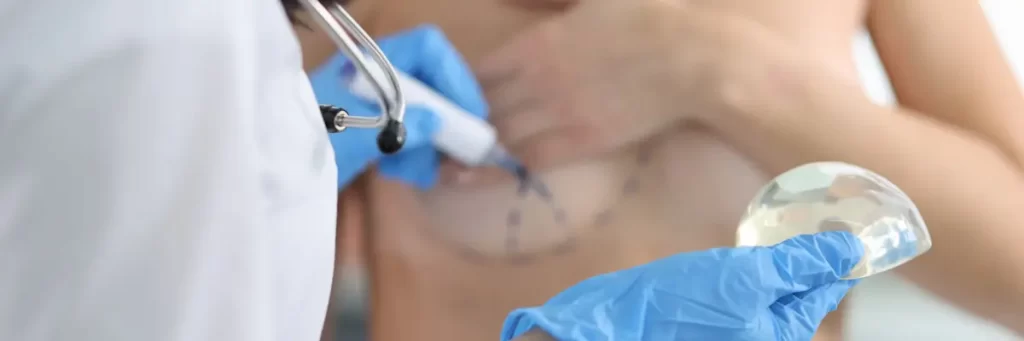 doctor draws marks female breast cosmetic surgery operation